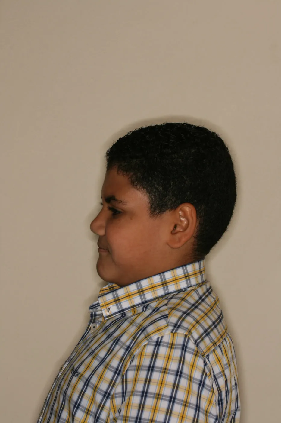 After treatment: Other results