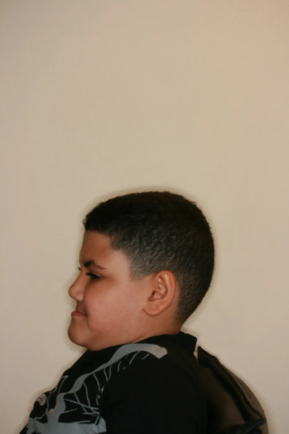 Before treatment: Other results
